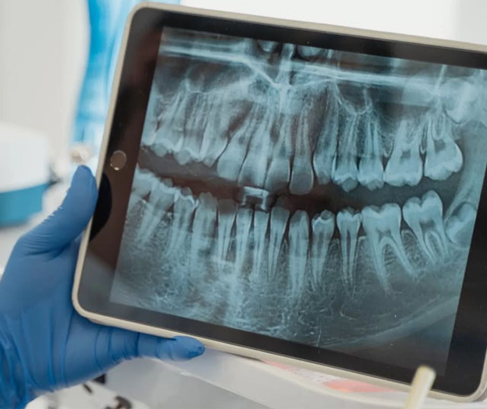 3D diagnostika