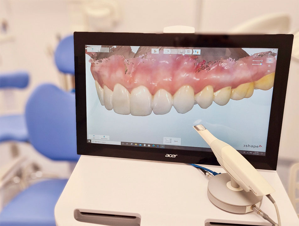 CAD/CAM laboratorinis frezavimas